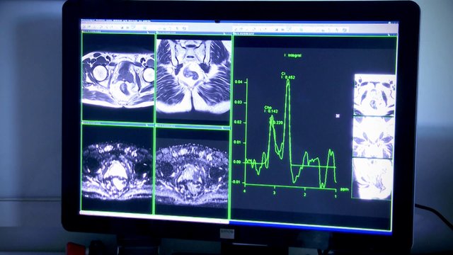 Medical Systems I.K.E.