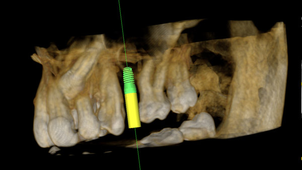 Medical Systems I.K.E.