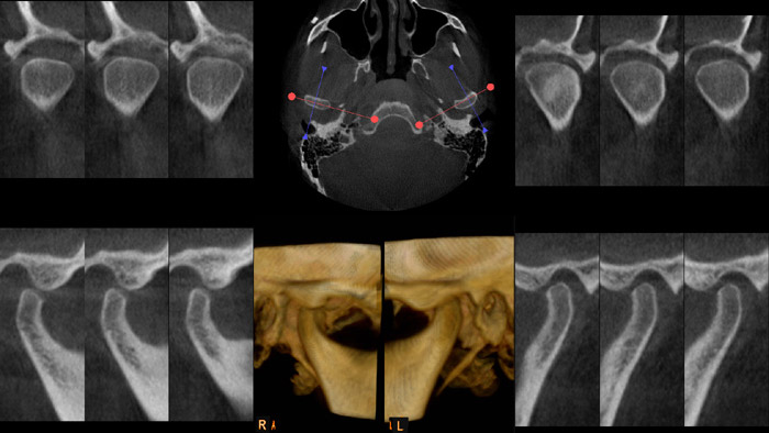Medical Systems I.K.E.