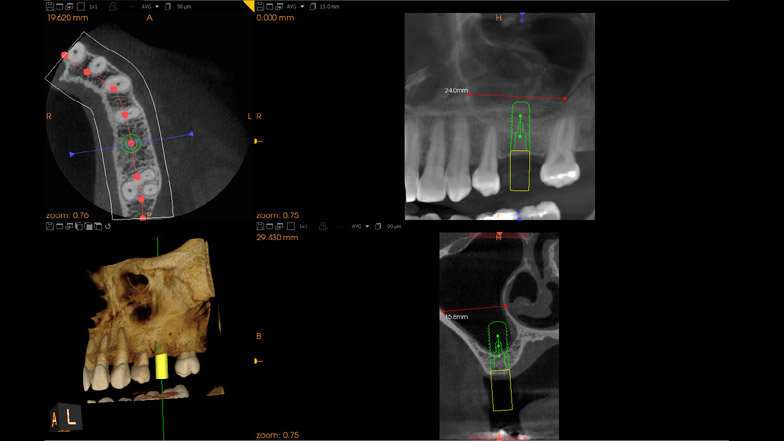 Medical Systems I.K.E.