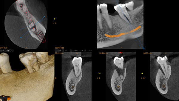 Medical Systems I.K.E.