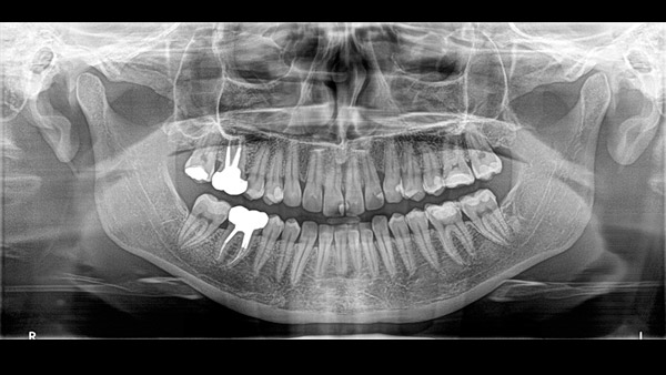 Medical Systems I.K.E.