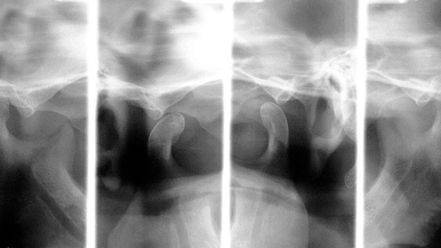 Medical Systems I.K.E.