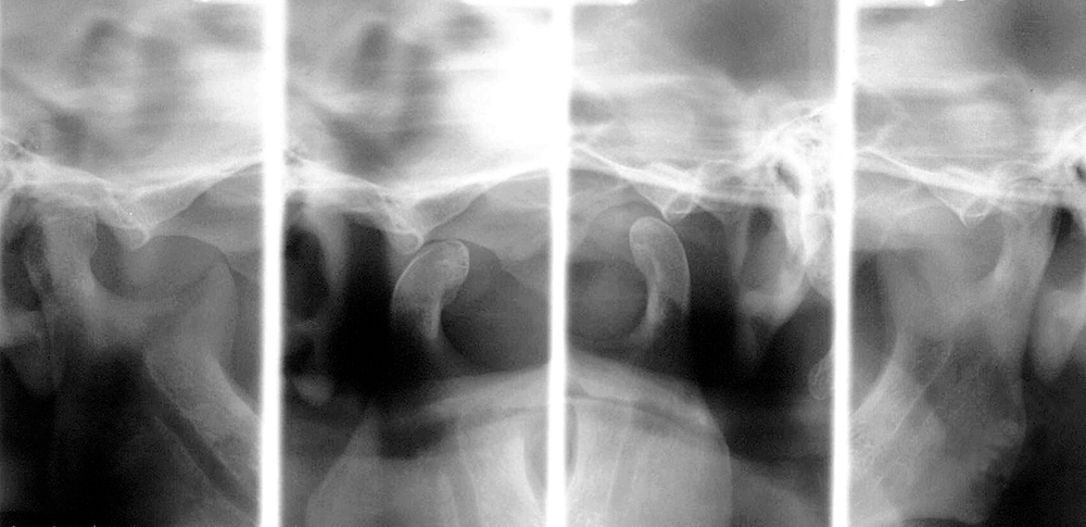 Medical Systems I.K.E.