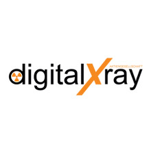 Digital Xray