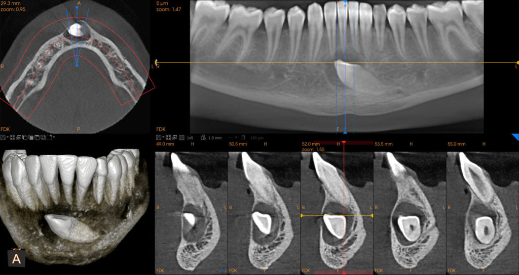 Medical Systems I.K.E.