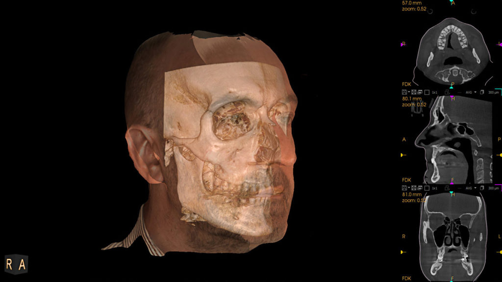 Medical Systems I.K.E.