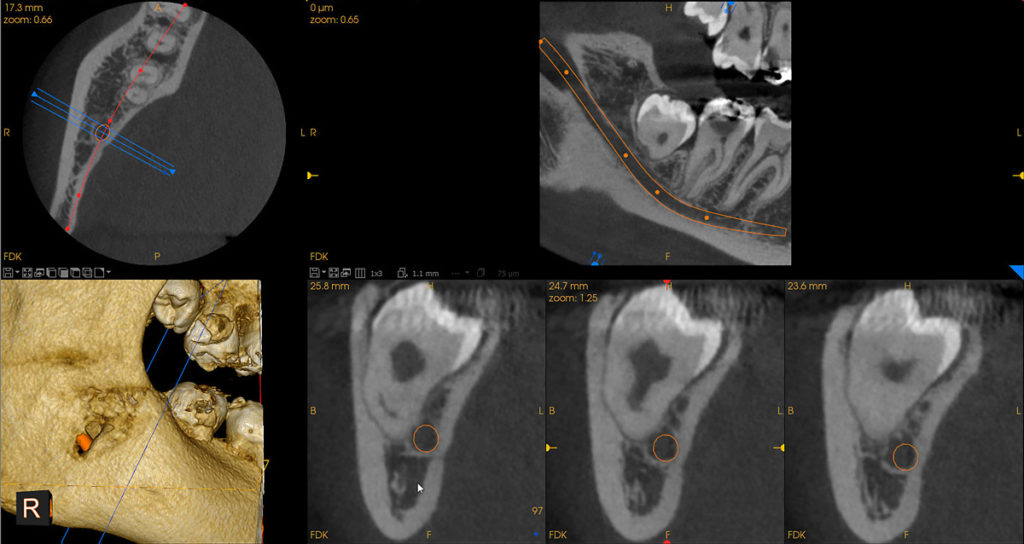 Medical Systems I.K.E.