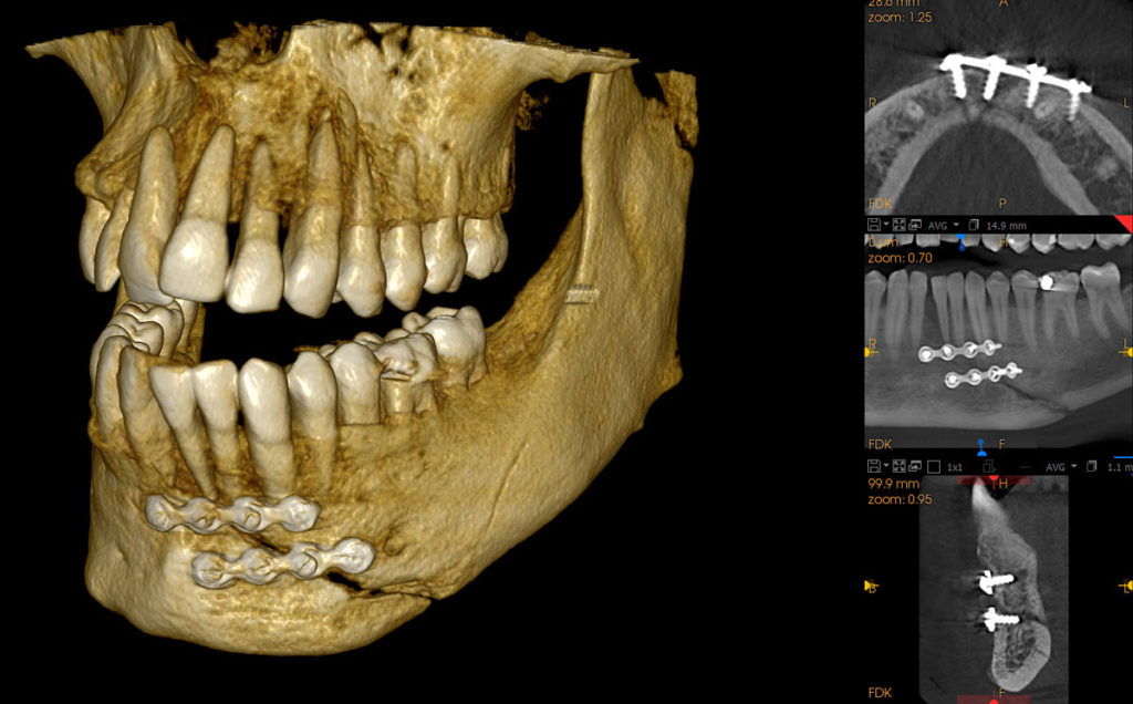 Medical Systems I.K.E.