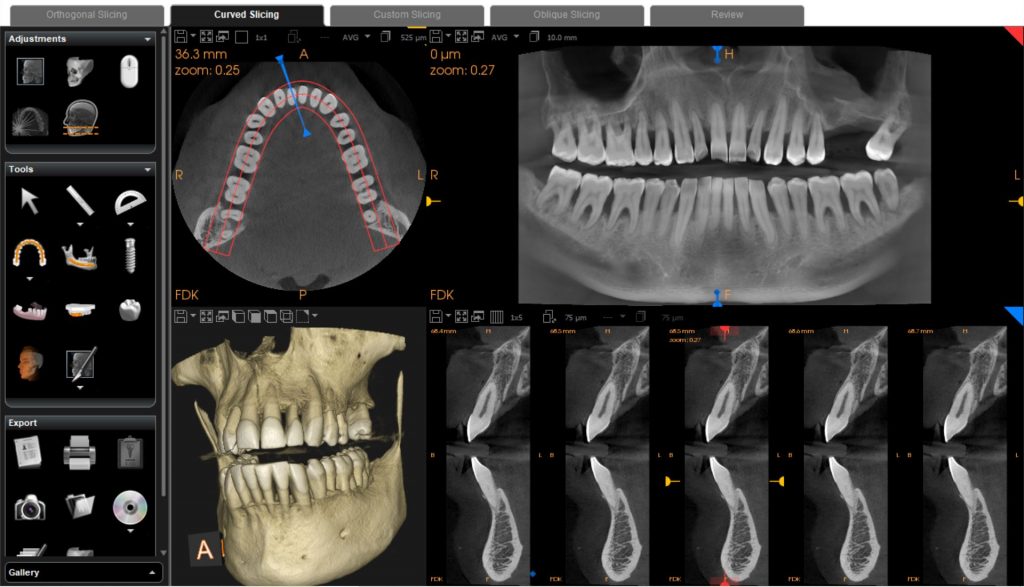 Medical Systems I.K.E.