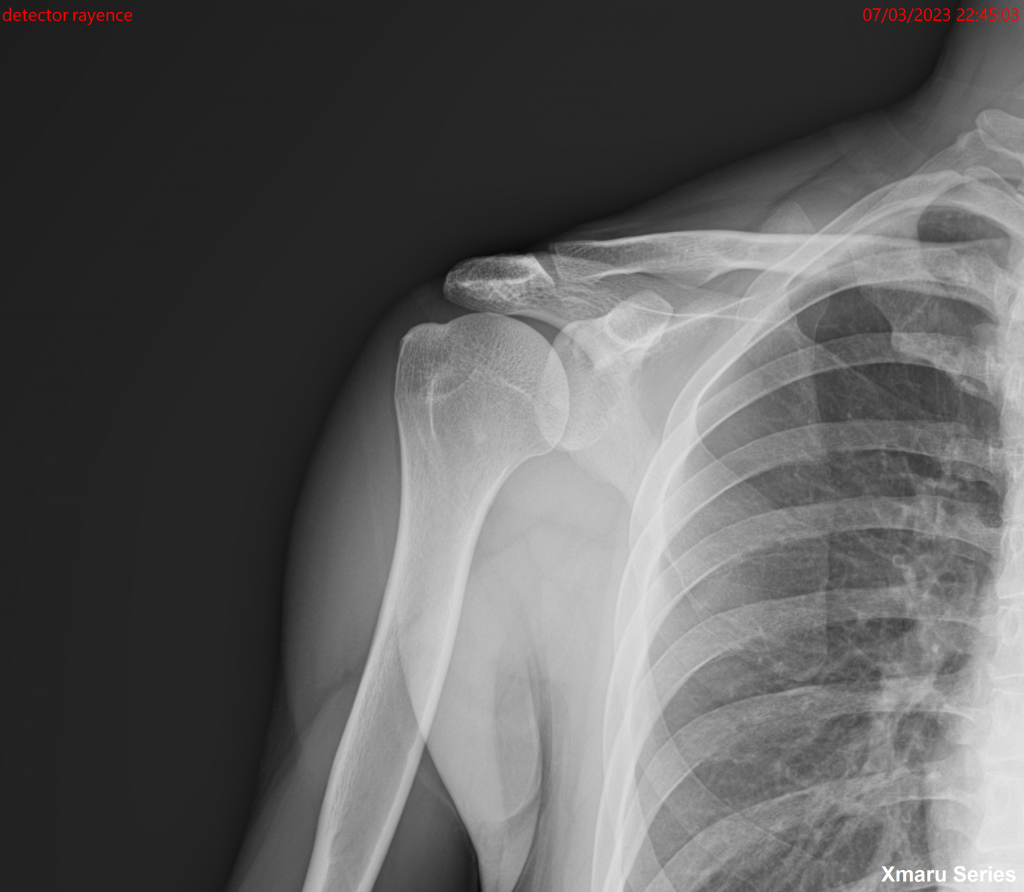 Medical Systems I.K.E.