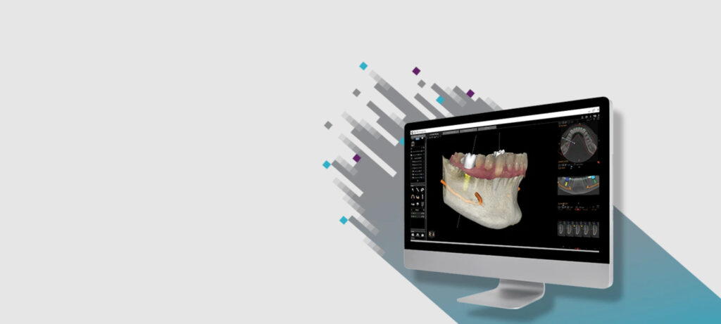 Medical Systems I.K.E.